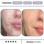 Advanced Nutrition Programme Skin Accumax (180 capsules)