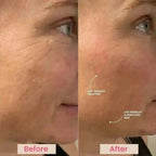 Lumo⁺ + Venus: Comprehensive Anti-Aging Solution for Face and Eyes