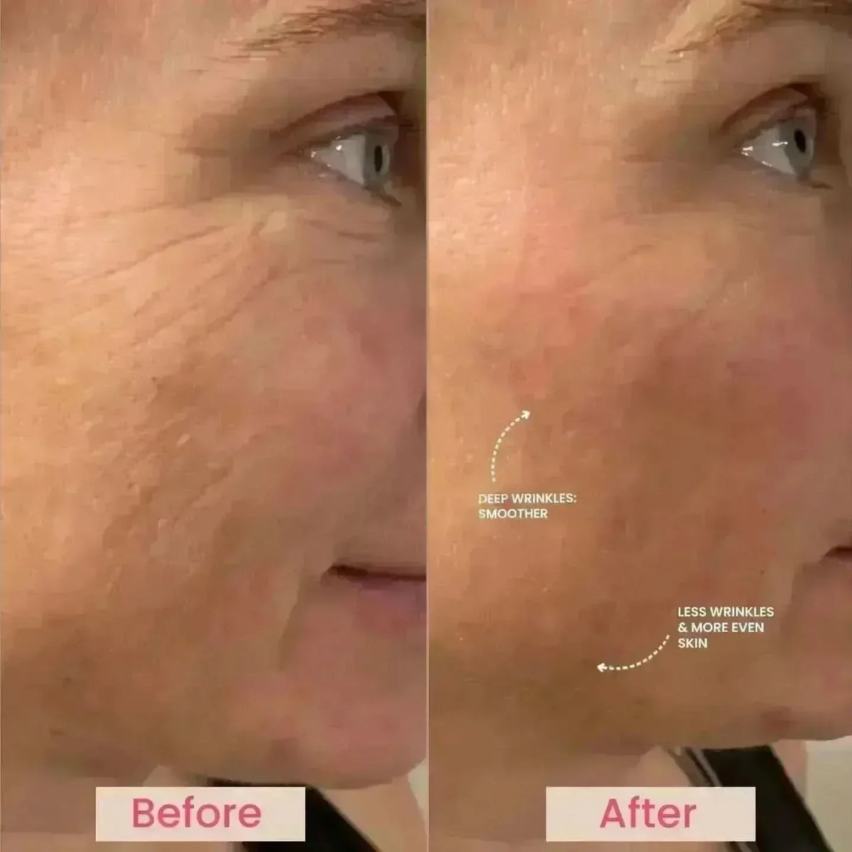 Lumo⁺ + Venus: Comprehensive Anti-Aging Solution for Face and Eyes