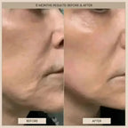 Lumo⁺ + Mirage + Venus: Complete Anti-Aging and Skin Rejuvenation Set