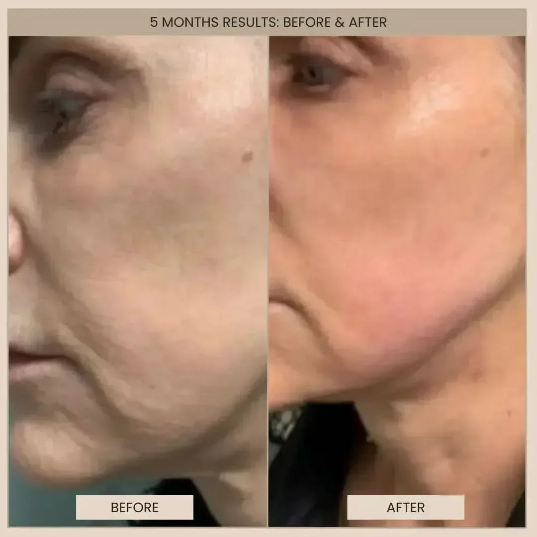 Lumo⁺ + Mirage + Venus: Complete Anti-Aging and Skin Rejuvenation Set