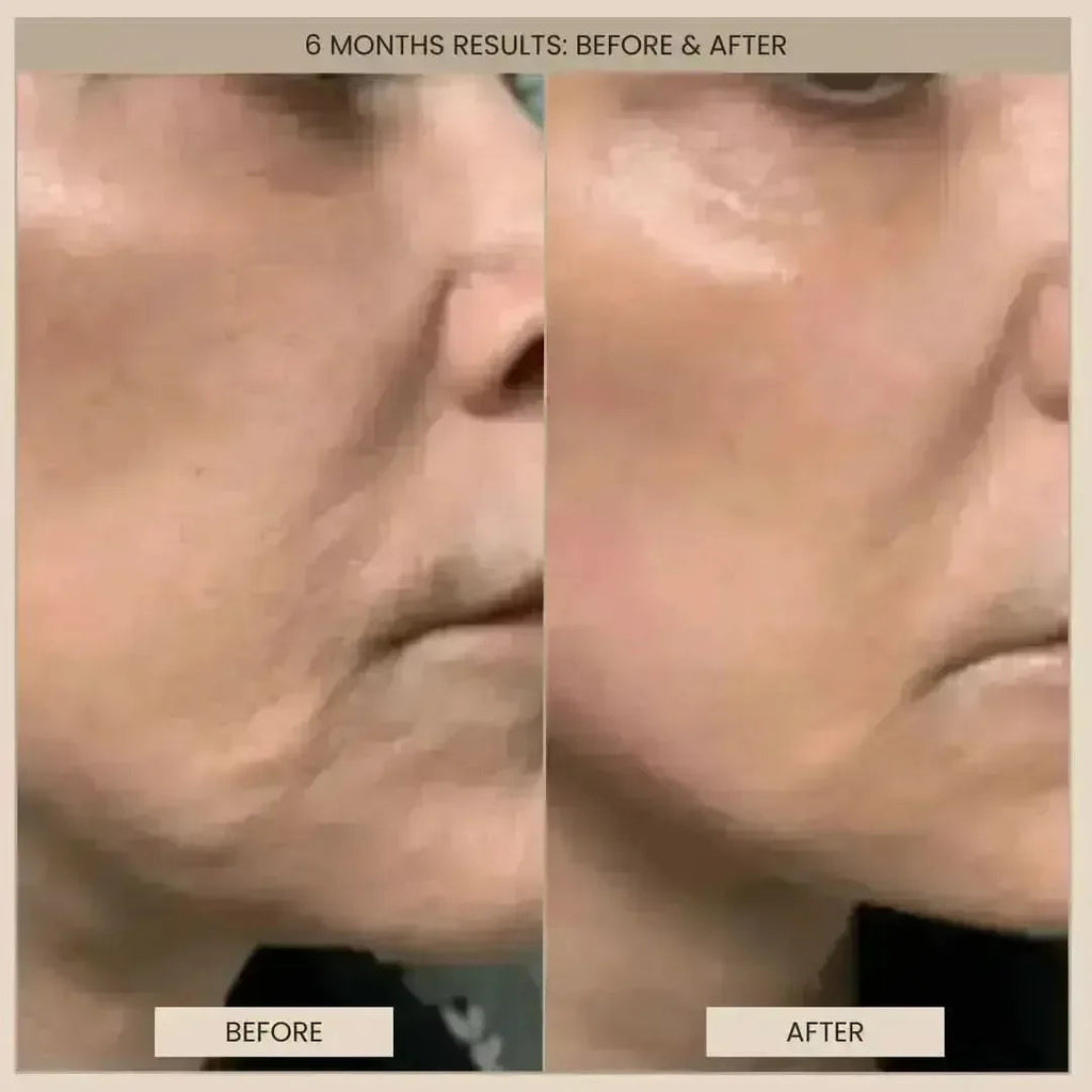 EvenSkyn® Lumo⁺: Premium Anti-Aging & Skin Tightening Handset (2026)