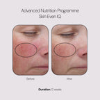 Advanced Nutrition Programme Skin Even IQ (28 Pods)