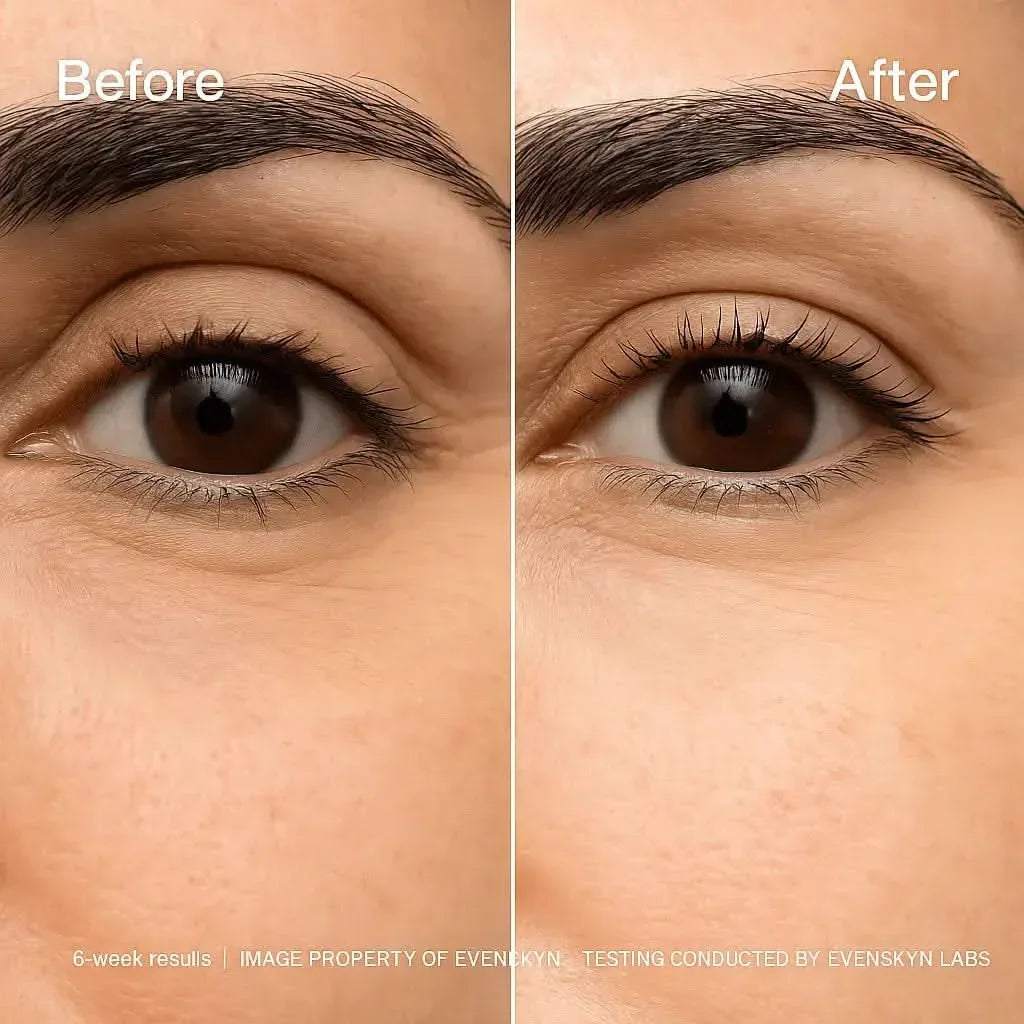 Under-Eye Micro Infusion Dissolving Hyaluronic Microneedle Eye Patches