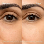 Under-Eye Micro Infusion Dissolving Hyaluronic Microneedle Eye Patches
